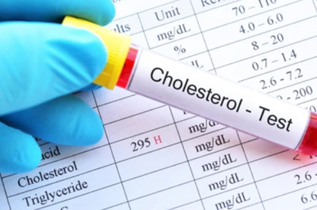 Chuyên gia chia sẻ 4 món ăn sáng giúp giảm cholesterol  - Ảnh 1.