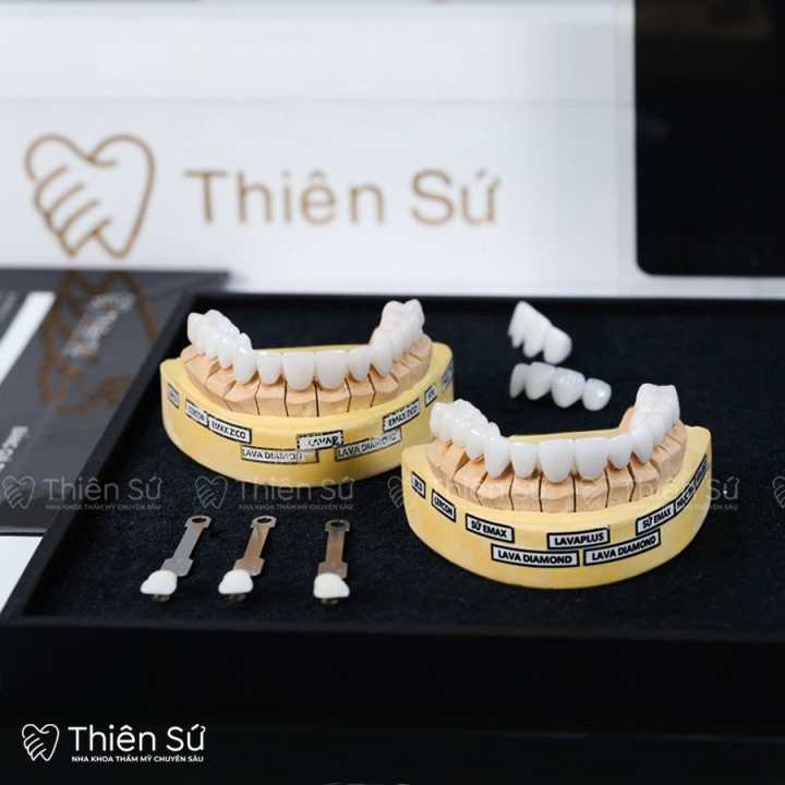 Nha Khoa Thiên Sứ - Hướng tới nụ cười hoàn hảo và sự tự tin vượt trội - 4