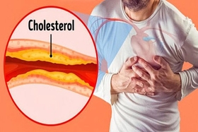 7 loại đồ uống giảm cholesterol tốt cho người tăng mỡ máu