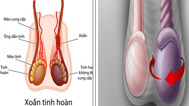 phu tho nam thanh nien hong cua quy do den vien muon hinh 1