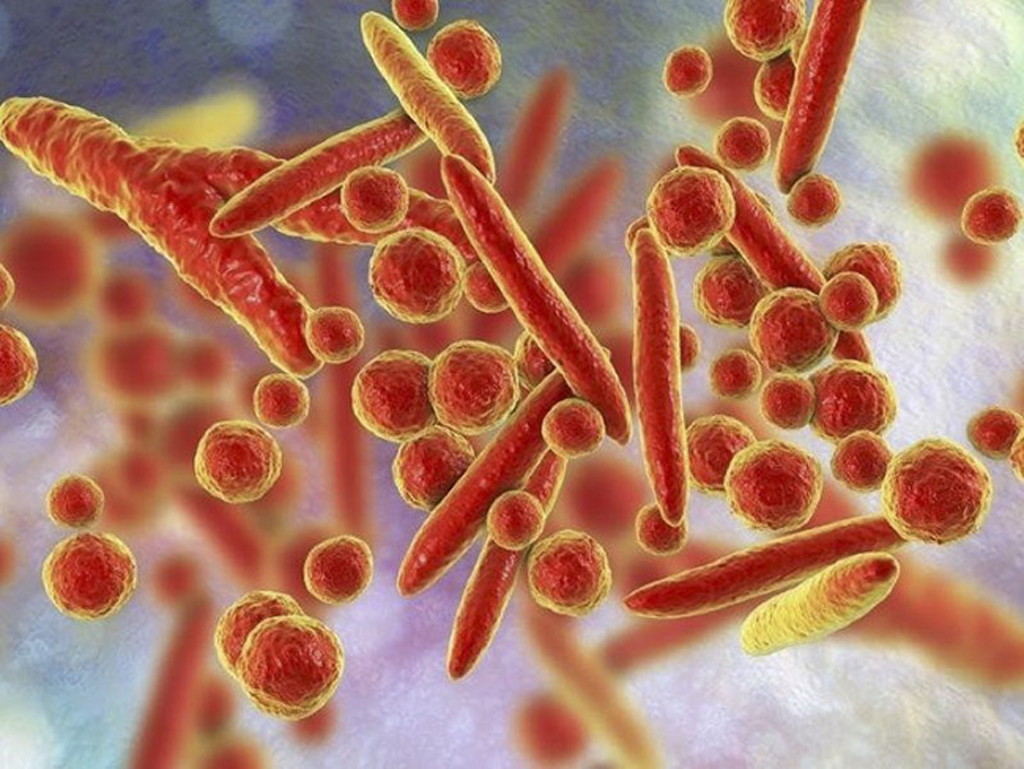 Gia tăng các ca viêm phổi do vi khuẩn Mycoplasma - Ảnh 2.