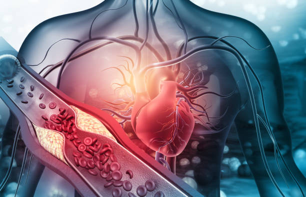 Loại quả thường có trong mâm cơm không ngờ giảm cả cholesterol, đường huyết   - Ảnh 1.