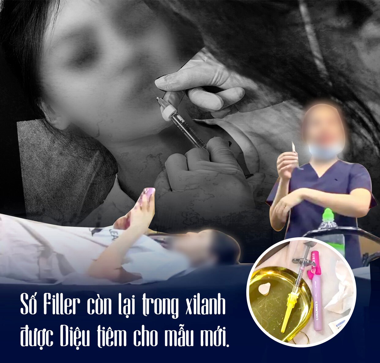 Trong ‘lò’ đào tạo tiêm filler chui: ‘Mình tiêm gì lên mặt nó sao nó biết mà lo’ - 7