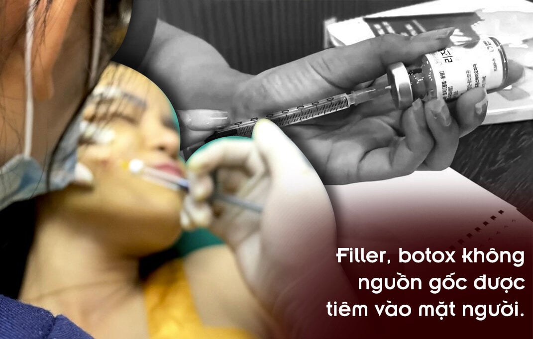 Góc tối thị trường filler 'xịn': Hàng rải bán trên đường dùng tiêm vào mặt người - 7