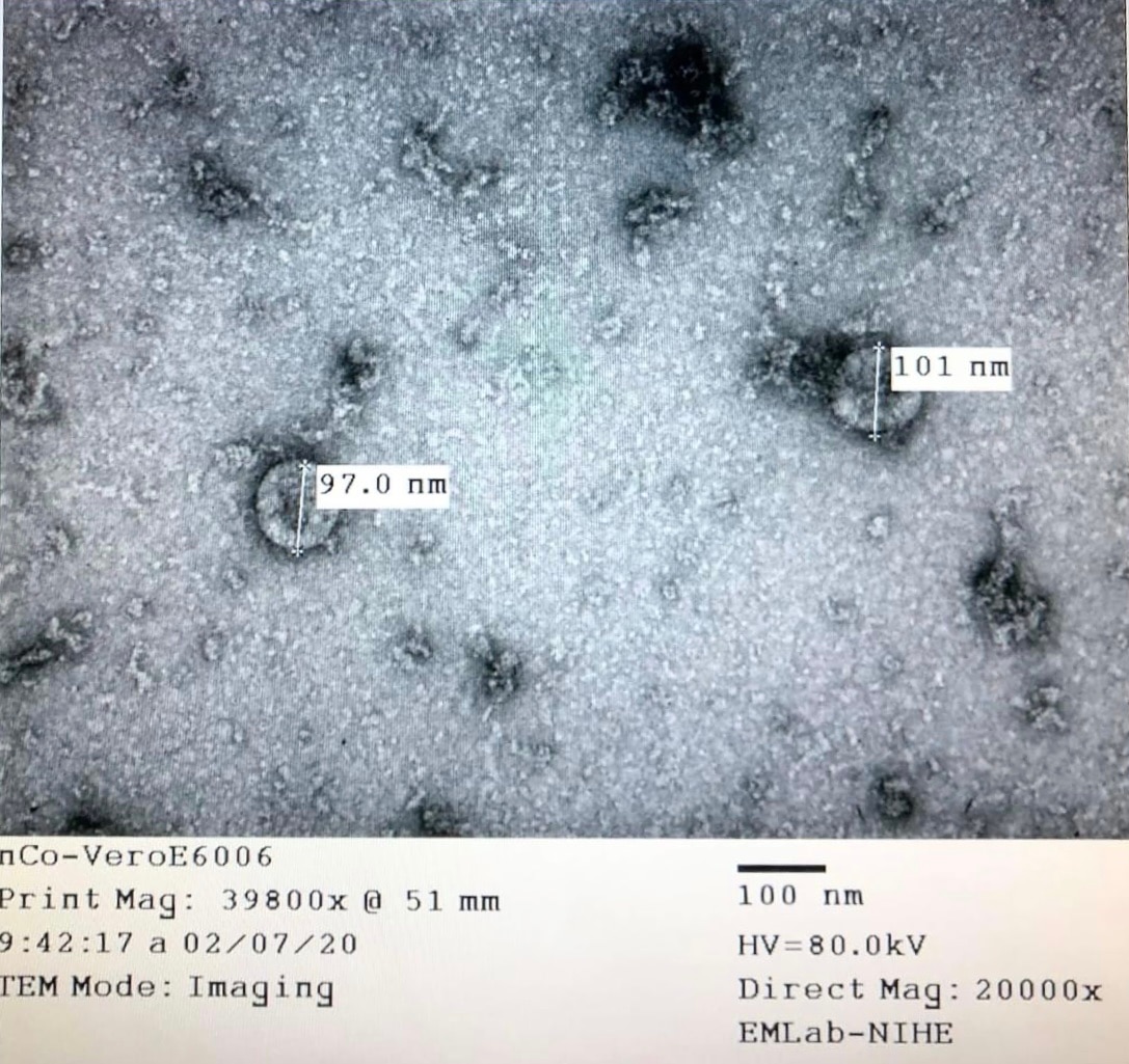 SARS-CoV-2 tiếp tục biến đổi, né miễn dịch- Ảnh 1.