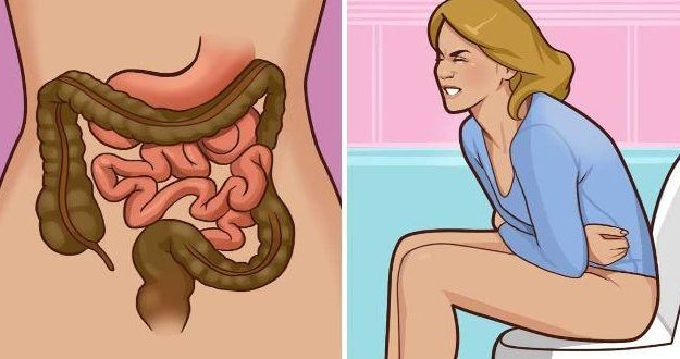 45-year-old man discovered he had stage 3 cancer because he delayed doing this - Photo 3. Người đàn ông 45 tuổi phát hiện mắc ung thư giai đoạn 3 vì trì hoãn làm việc này - Ảnh 3.