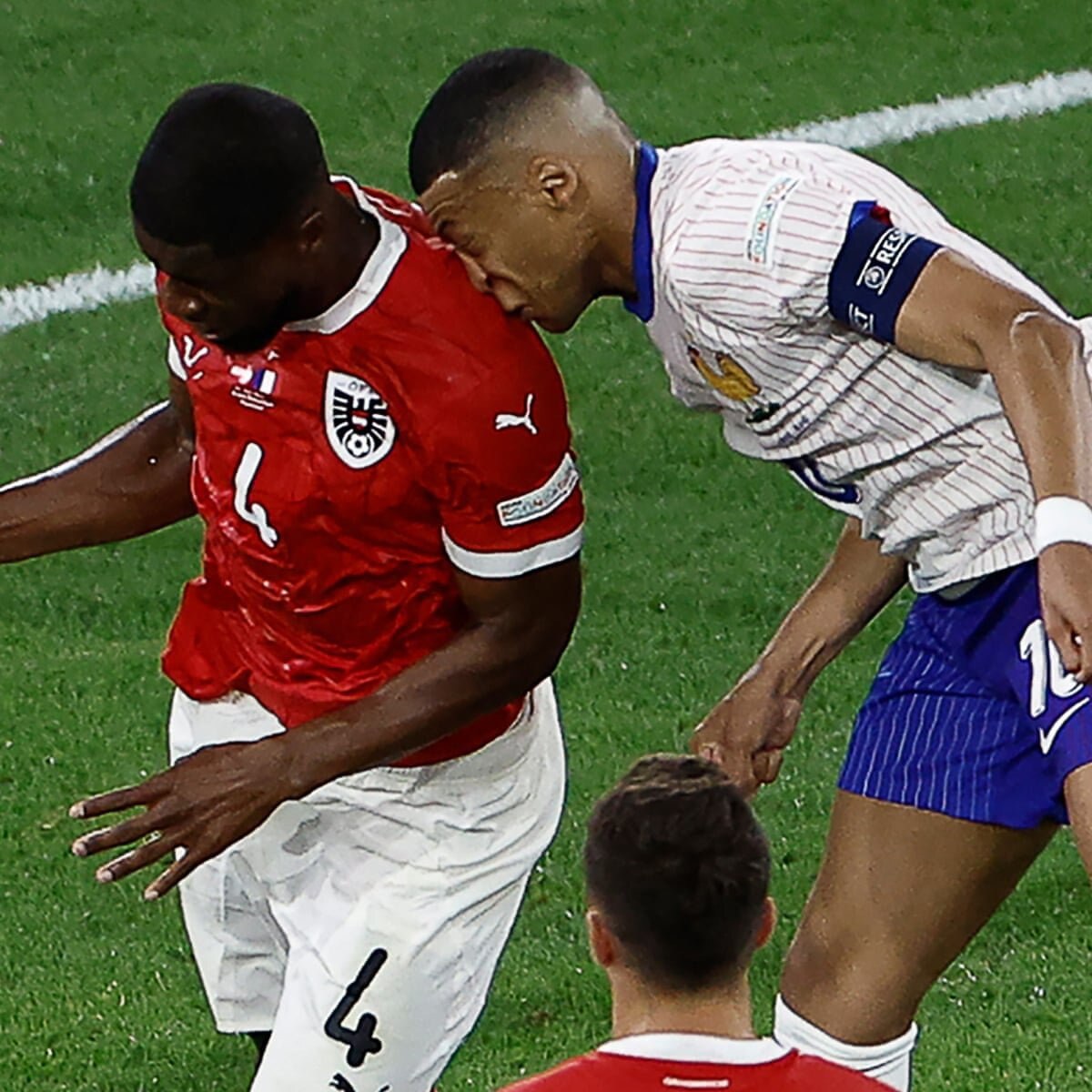 Pháp chơi canh bạc mạo hiểm với Mbappe, CLB Real Madid: Làm ơn, hãy sớm phẫu thuật mũi- Ảnh 3.