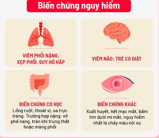 Ca bệnh ho gà tại Hà Nội tăng cao- Ảnh 1.