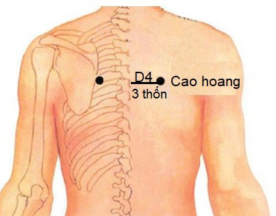 Vị trí huyệt cao hoang - Ảnh: BSCC