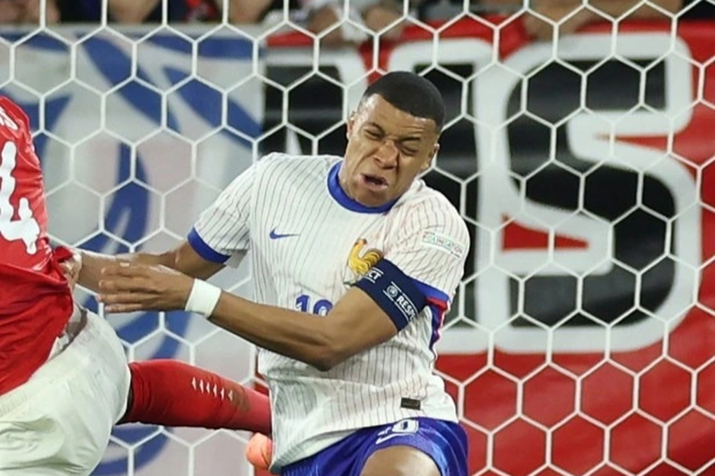 Mbappe trở lại tập luyện cùng tuyển Pháp sau khi bị gãy mũi - 1