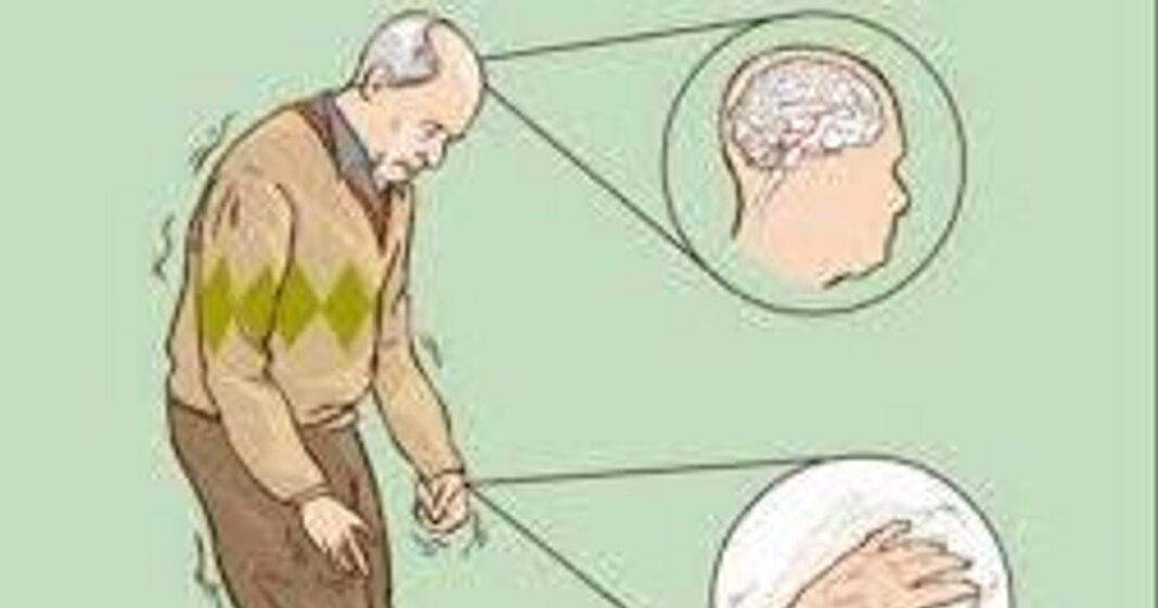 Người mắc bệnh Parkinson cần tập phục hồi chức năng