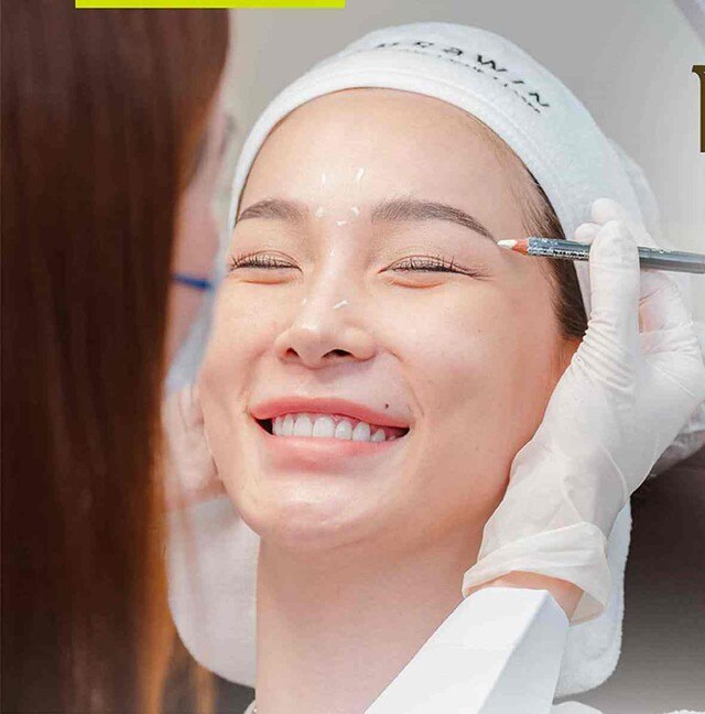 Hiệu ứng gây sốt làm đẹp từ bão mạng với Jelly Roll Botox liệu có an toàn?- Ảnh 2.