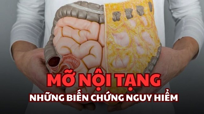 Mỡ nội tạng và nhiều biến chứng nguy hiểm