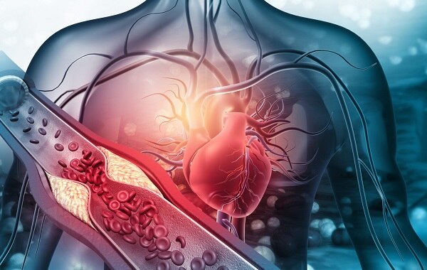 Bí quyết ăn uống giúp giảm cholesterol hiệu quả nhất- Ảnh 1.