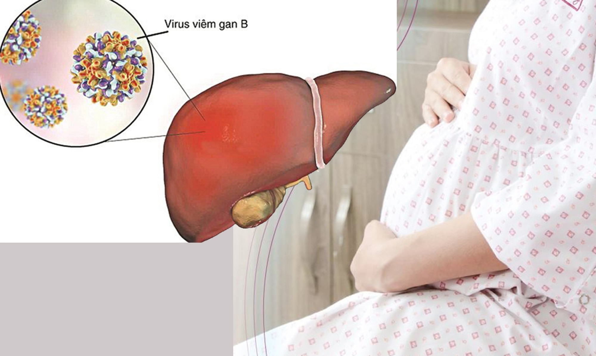 Virus viêm gan B ảnh hưởng đến thai phụ ra sao?- Ảnh 1.