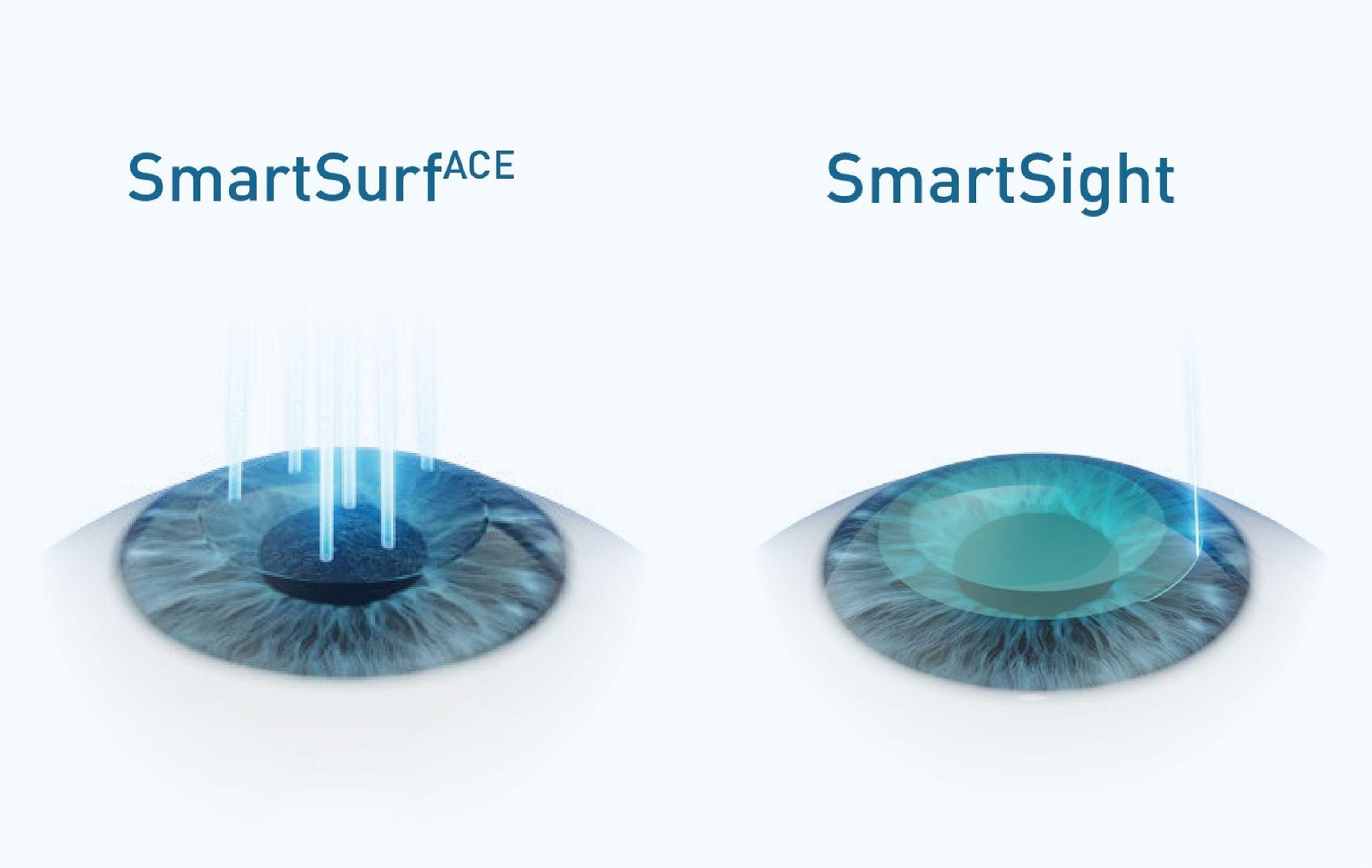 Từ SmartSurfACE đến SmartSight: Lựa chọn phẫu thuật tối ưu cho bác sĩ khúc xạ- Ảnh 2.