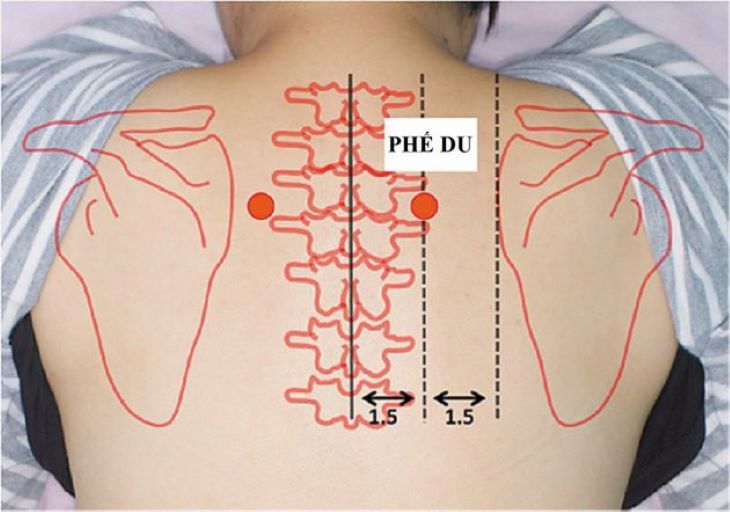  Giảm đau cổ vai gáy bằng các phương pháp đơn giản tại nhà - Ảnh 4.