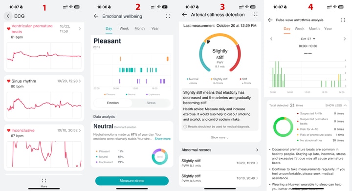 Ngoài ECG (1), người dùng còn có thể theo dõi chỉ số cảm xúc (2) mỗi ngày. Cùng với đó là những cảm biến chỉ số thể chất quan trọng từng xuất hiện gần đây như đo phát hiện xơ cứng động mạch (3), cảm biến phát hiện trạng thái rung tâm nhĩ (4), chất lượng giấc ngủ, mức độ căng thẳng... Đây đều là những chỉ số quan trọng liên quan trực tiếp tới sức khỏe, sinh hoạt hàng ngày của người dùng. Dù các chỉ số ghi nhận trên đồng hồ mang tính tham khảo, việc phát hiện sớm những dấu hiệu tim mạch và được cảnh báo sẽ giúp giảm tối đa rủi ro ảnh hưởng tiêu cực tới sức khỏe.