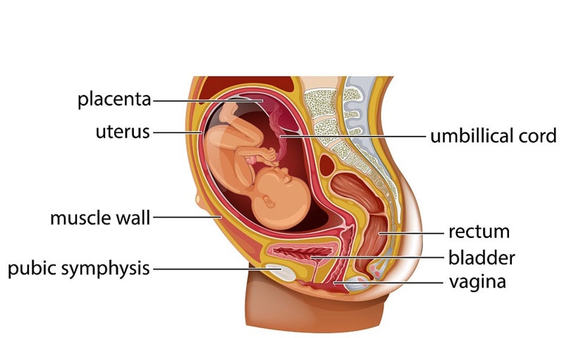 Rau bám thấp là hiện tượng bánh rau thai bị lệch khỏi vị trí đáy tử cung