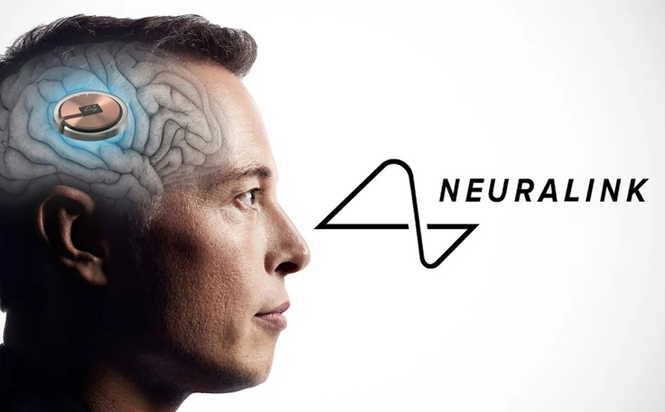 Canada cho phép Neuralink của tỷ phú Elon Musk thử nghiệm cấy chip vào não người.