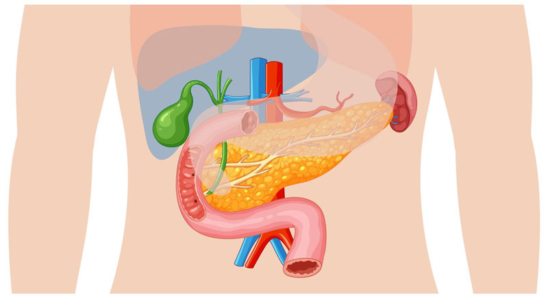 Sỏi túi mật - một dạng bệnh lý lành tính, không quá nguy hiểm