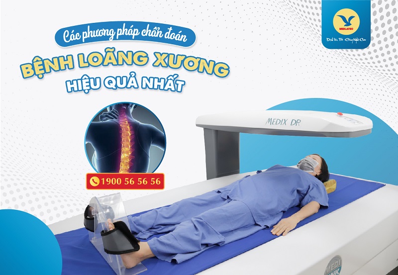 Người bệnh đo DEXA - một trong các phương pháp chẩn đoán bệnh loãng xương đang áp dụng tại MEDLATEC