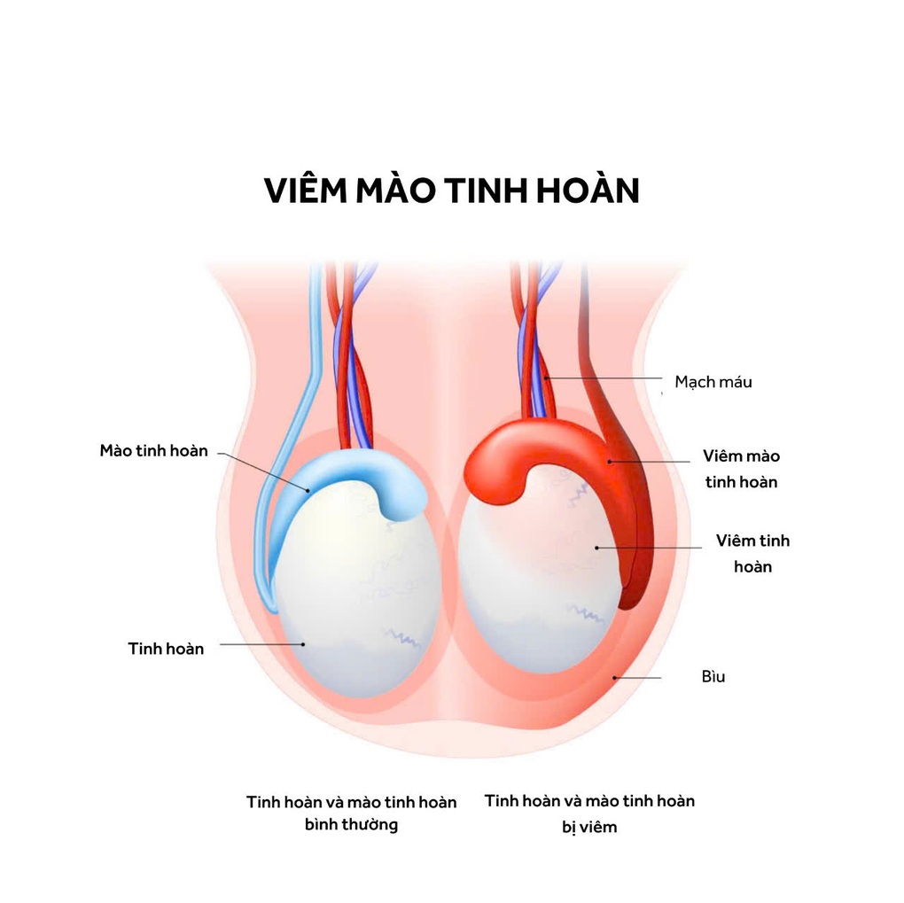 Từ nỗi lo vô sinh sau biến chứng quai bị đến hành trình làm cha đầy bất ngờ - 2