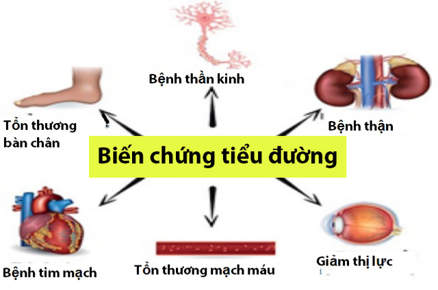 Người đàn ông mắc bệnh tiểu đường bị biến chứng nặng ở mắt, bác sĩ khuyến cáo ai mắc bệnh tiểu đường cần làm điều này để phòng biến chứng - Ảnh 3.