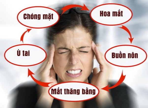 Người mắc bệnh tiền đình cần làm gì để nhanh khỏi, không bị tái phát - Ảnh 3.