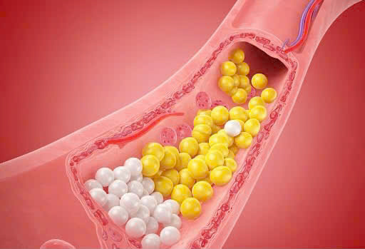 Bác sĩ trả lời: Ăn trứng mỗi ngày có ảnh hưởng đến cholesterol?- Ảnh 2.