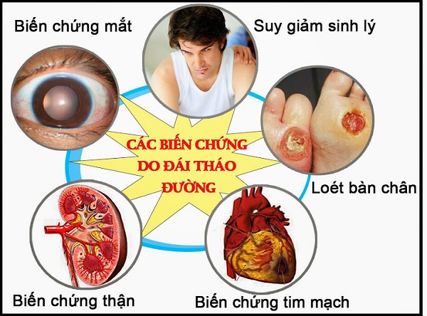 Bất ngờ nguyên nhân gây nguy cơ mắc bệnh tiểu đường rất nhiều người Việt bỏ qua- Ảnh 3.