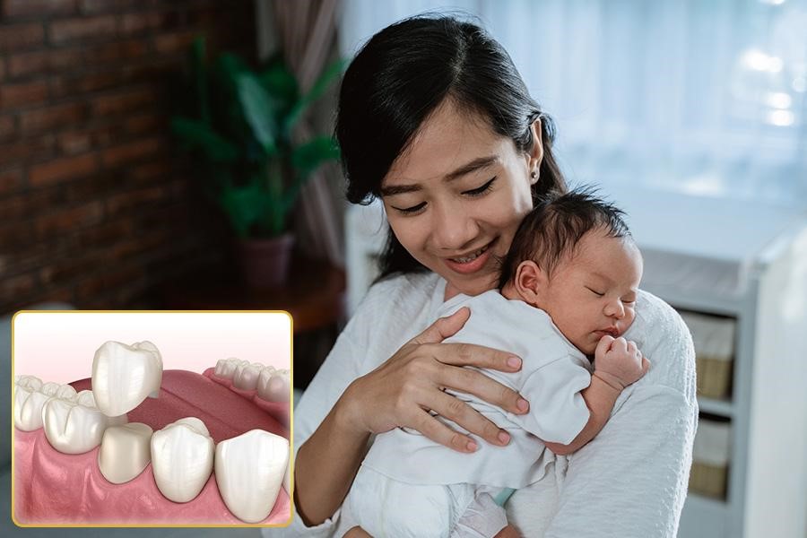 Đang cho con bú có bọc răng sứ được không?- Ảnh 1. Đang cho con bú có bọc răng sứ được không?- Ảnh 1.