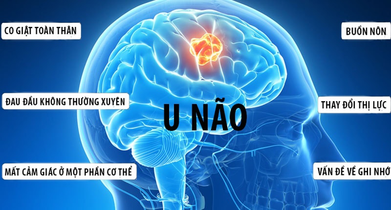 Diễn viên Quý Bình qua đời ở tuổi 42, căn bệnh anh mắc phải nguy hiểm thế nào?- Ảnh 2.