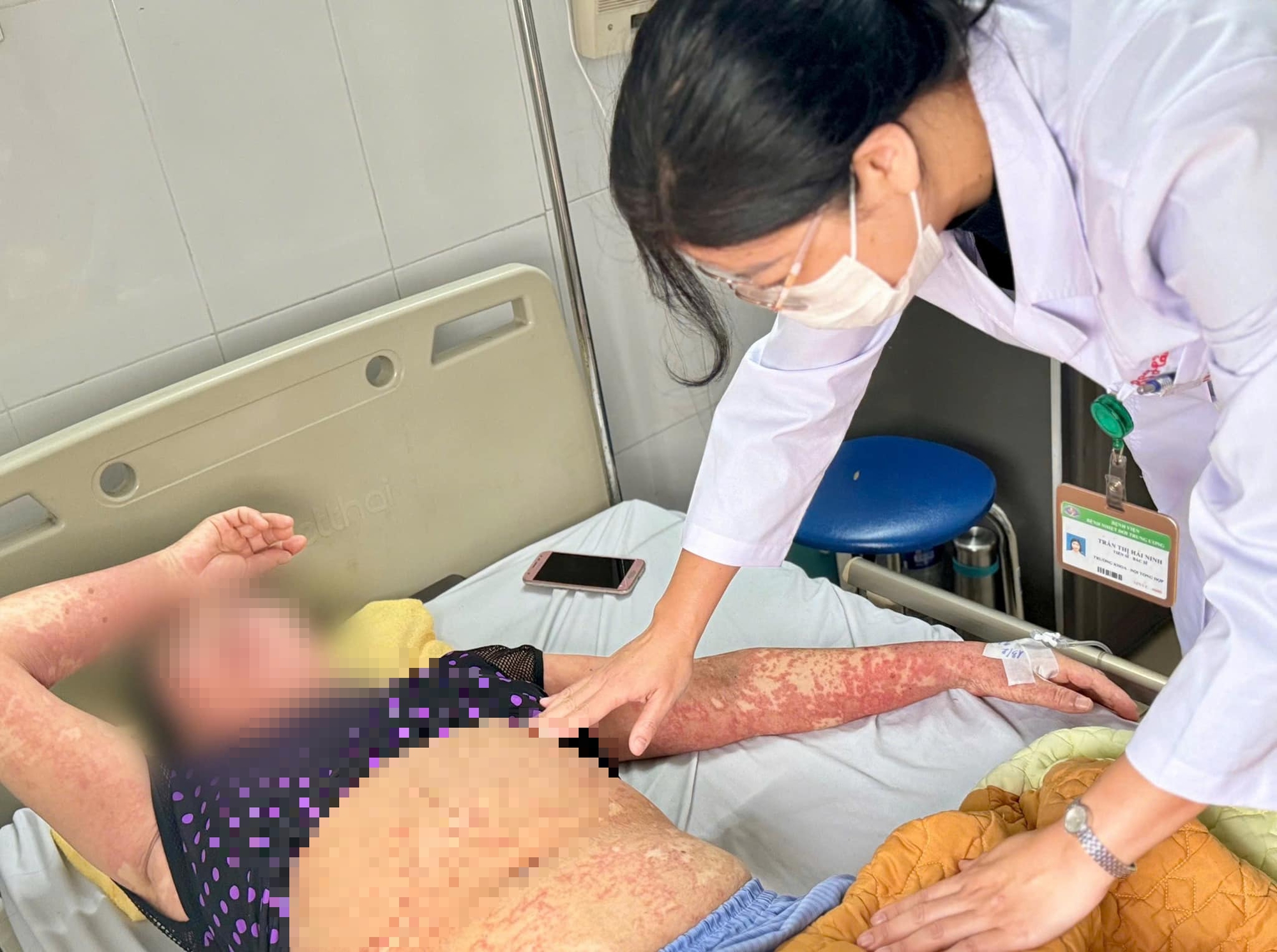 Người phụ nữ bị ngứa dữ dội, mặt sưng phù sau khi uống thuốc- Ảnh 1. Người phụ nữ bị ngứa dữ dội, mặt sưng phù sau khi uống thuốc- Ảnh 1.