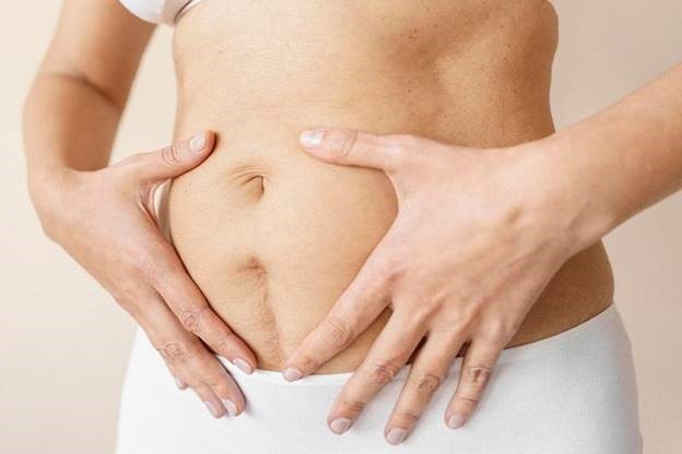 Góc giải đáp: Sẹo mổ đẻ có hết được hoàn toàn mà không cần xâm lấn? - Ảnh 3.